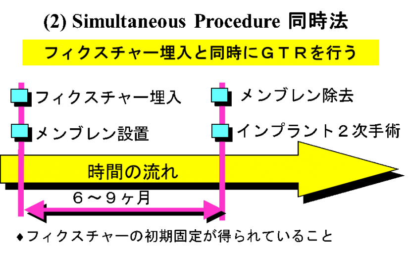 GBR・GTR - 新谷悟の歯科口腔外科塾
